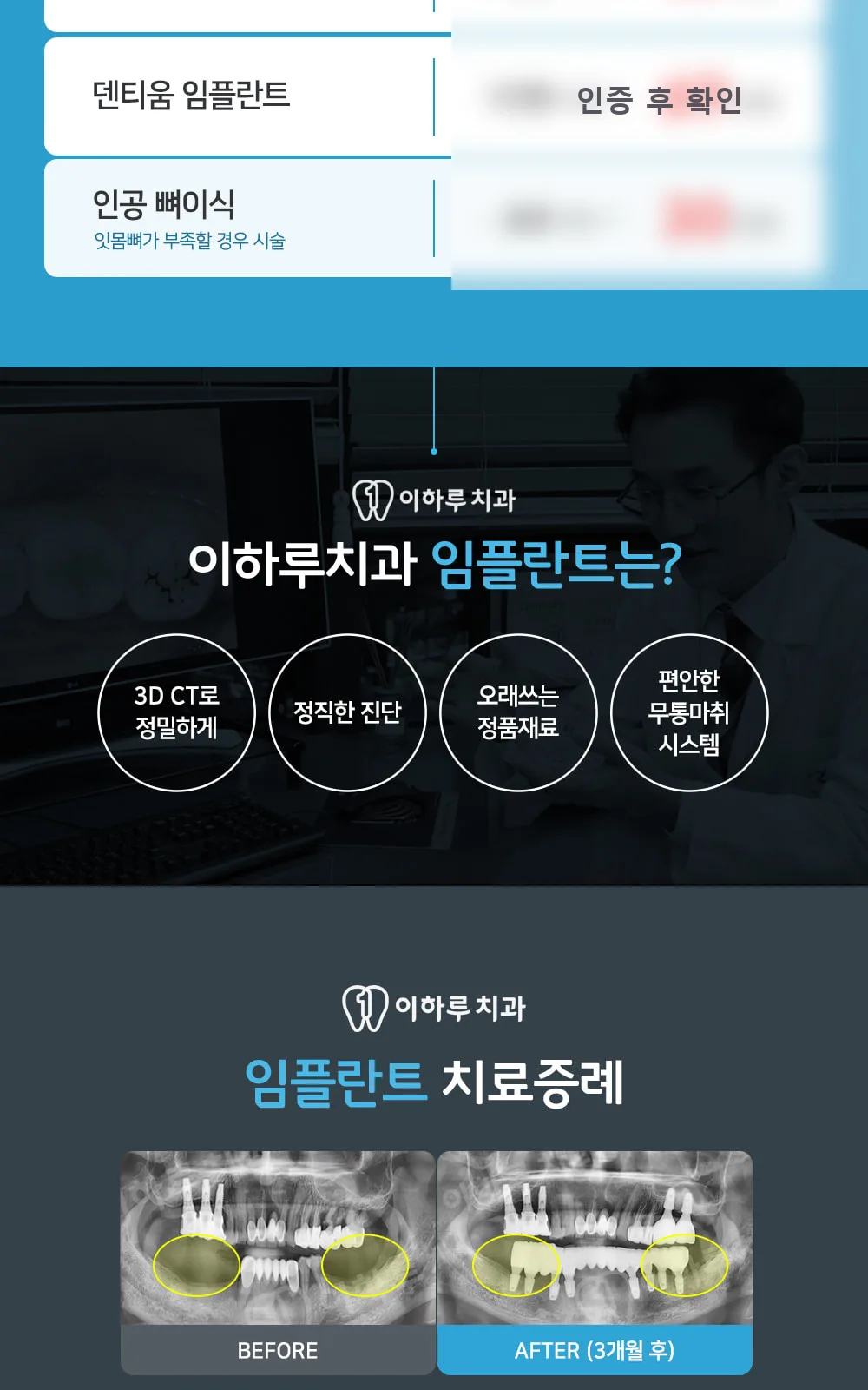 시술 상세 4
