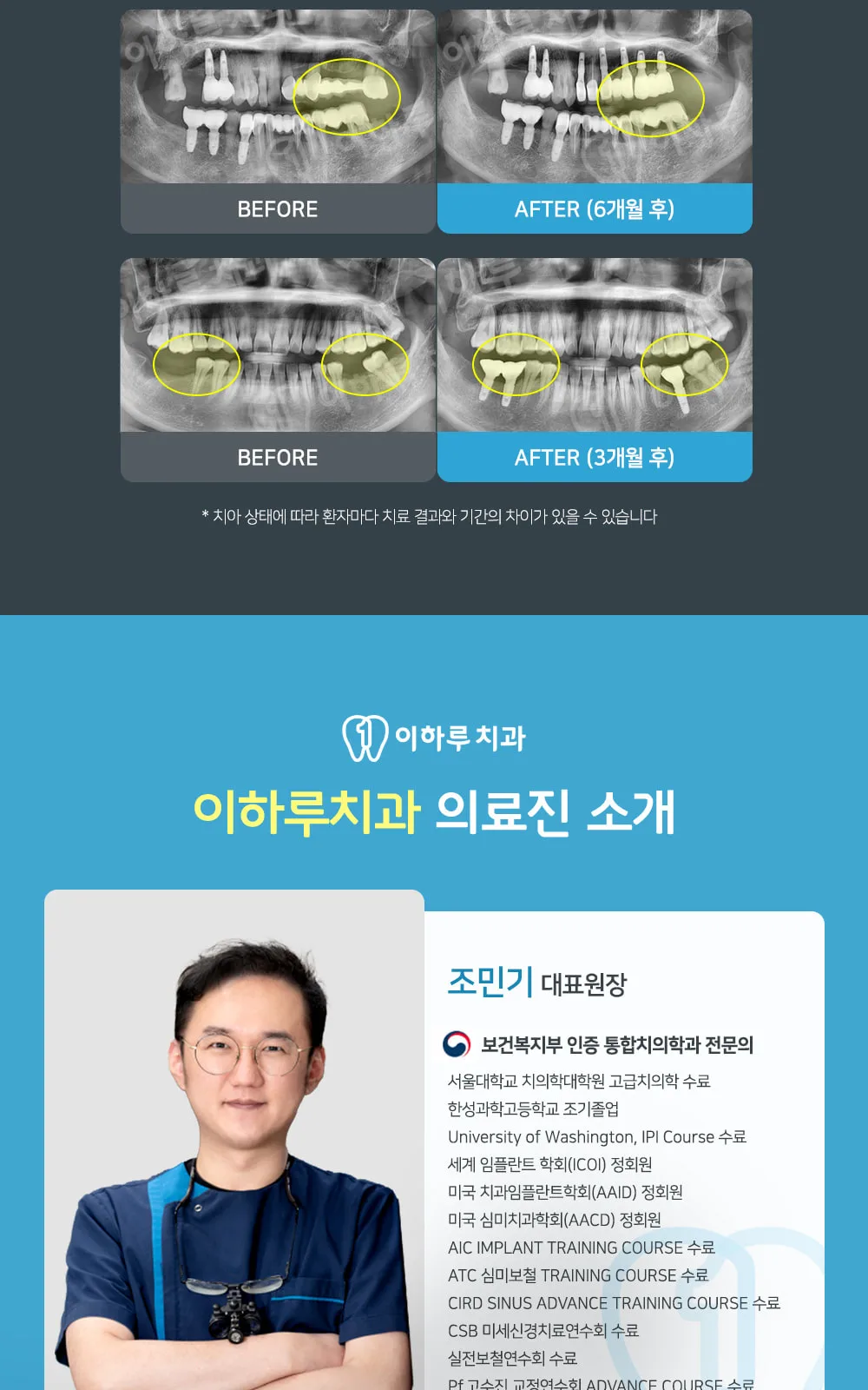 시술 상세 5
