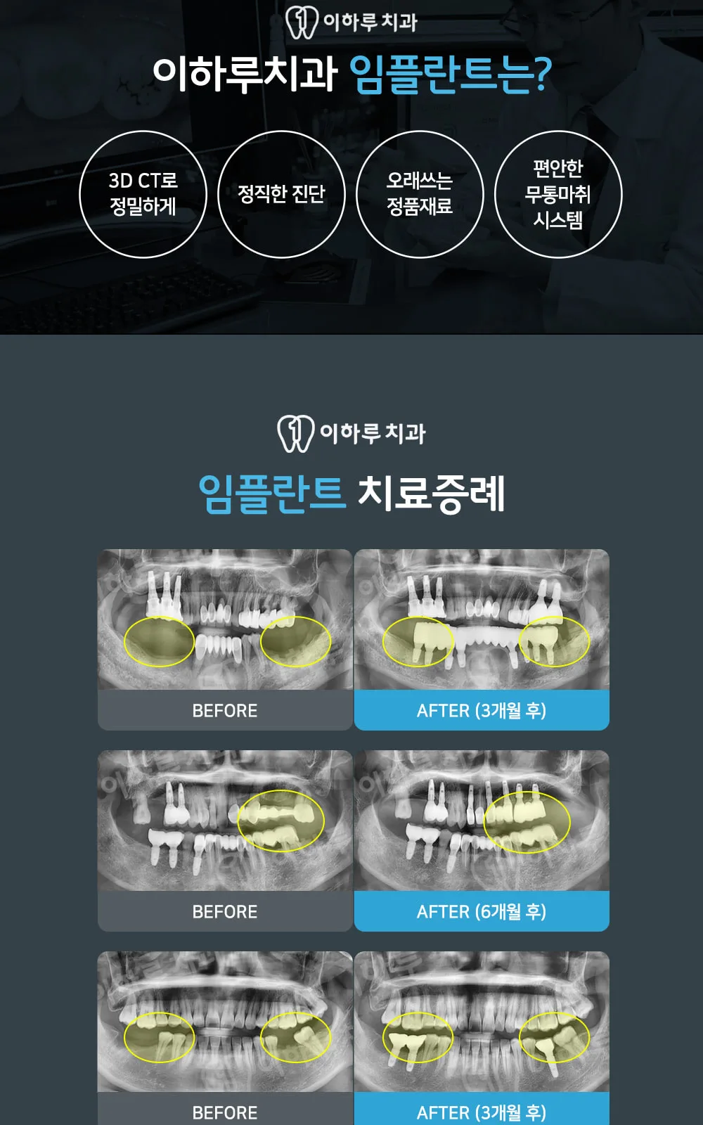 시술 상세 5