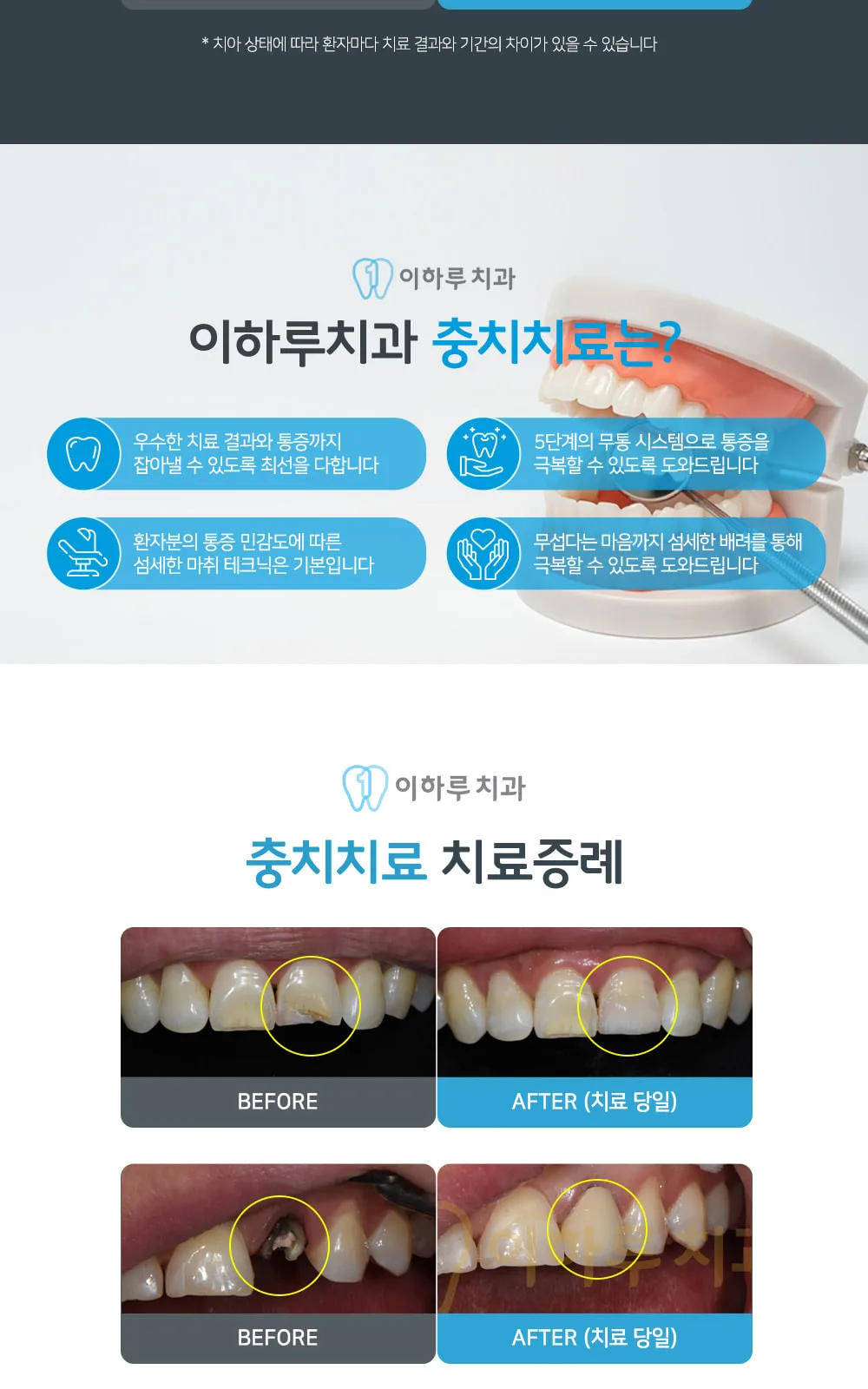 시술 상세 6
