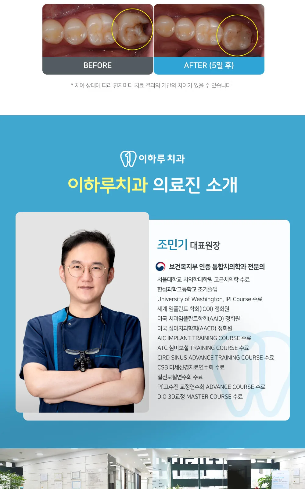 시술 상세 7
