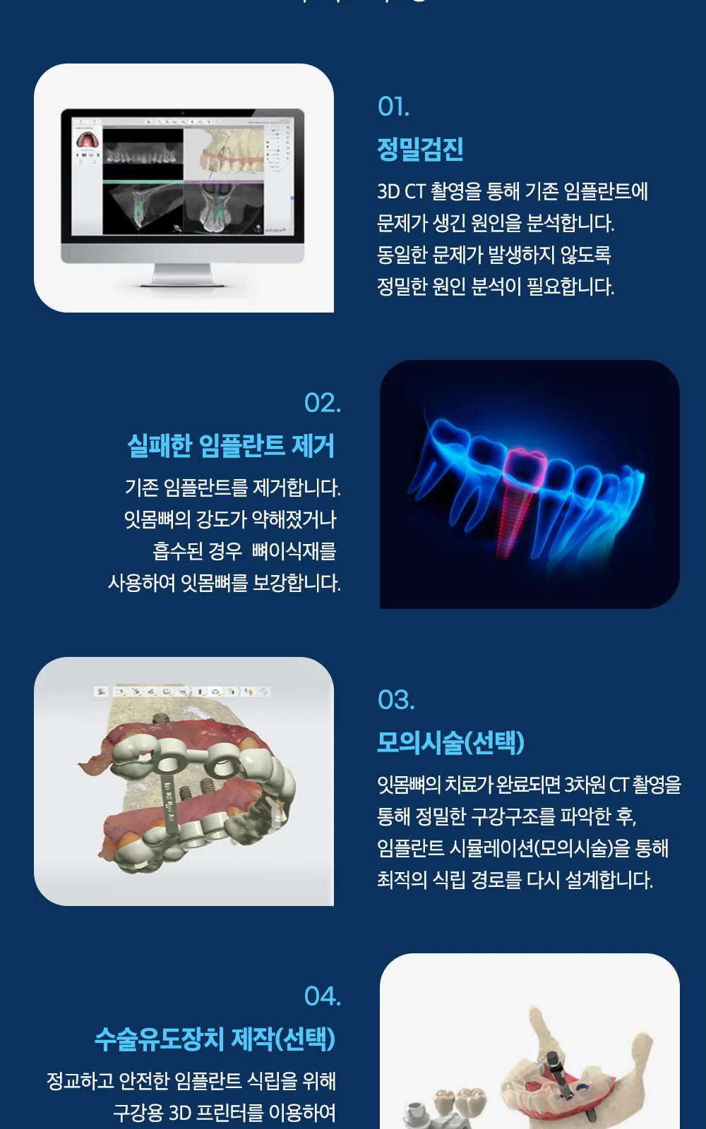 시술 상세 12
