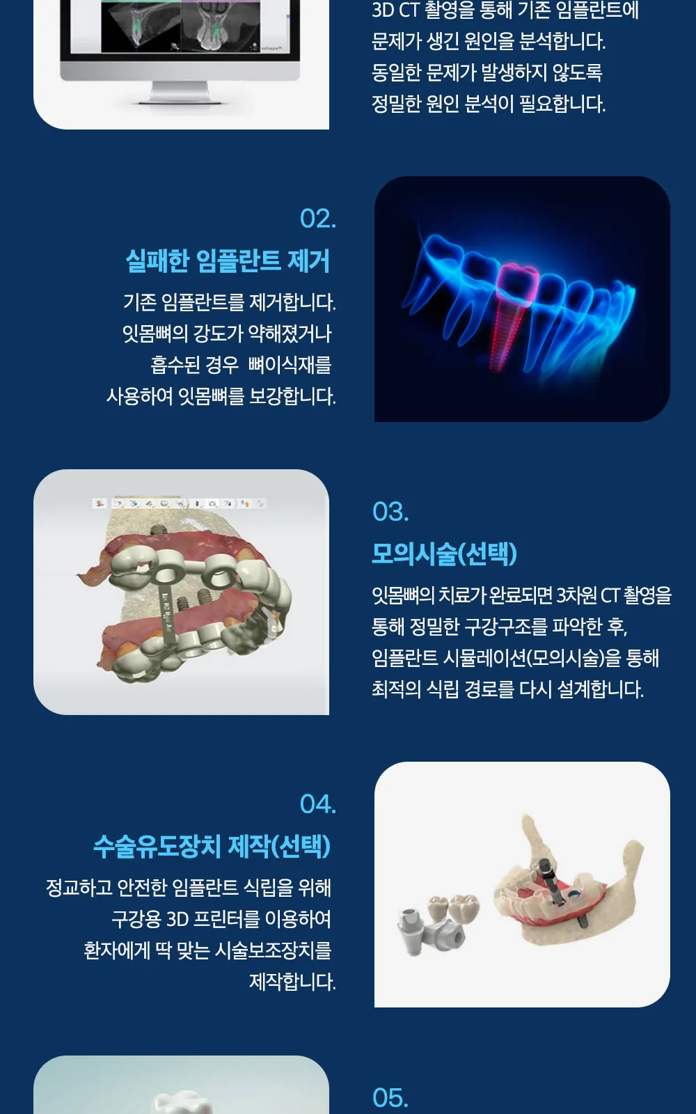 시술 상세 13