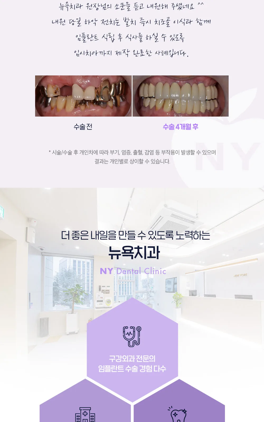 시술 상세 6
