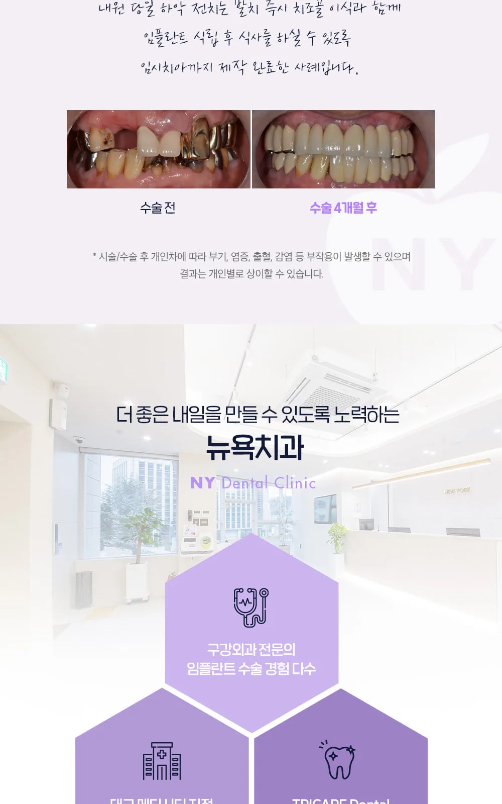 시술 상세 5