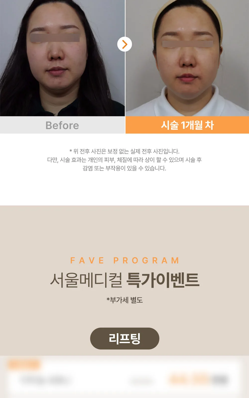 시술 상세 8