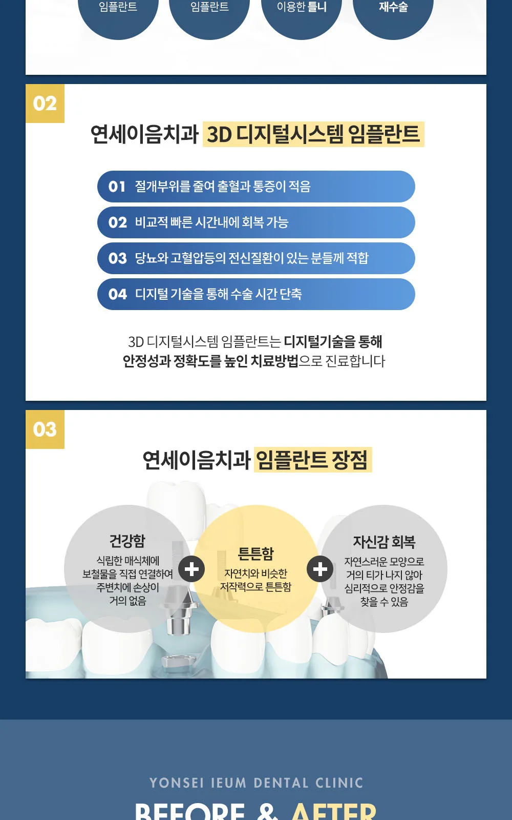 시술 상세 4