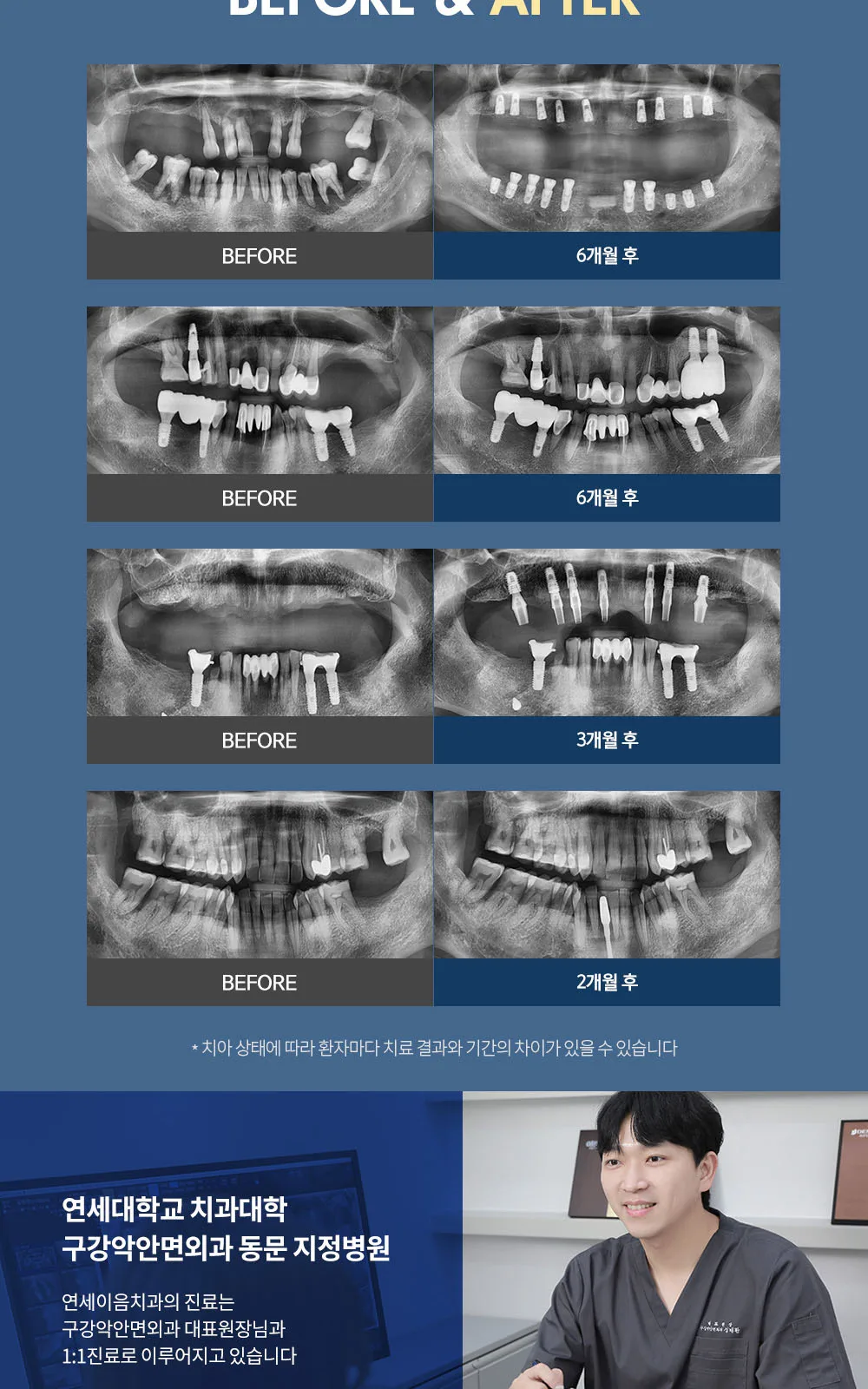 시술 상세 5