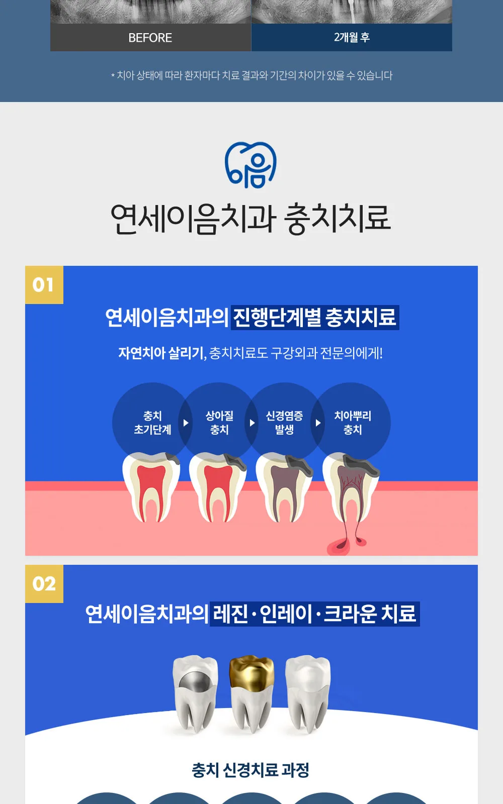 시술 상세 6