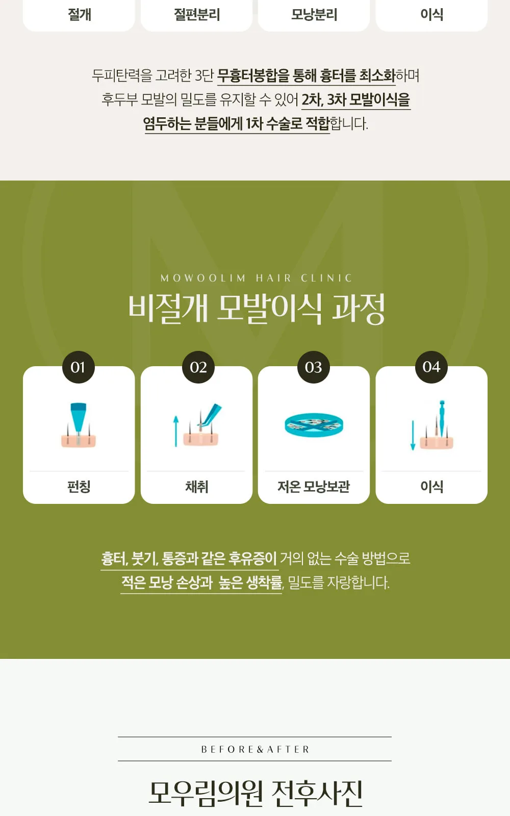 시술 상세 6