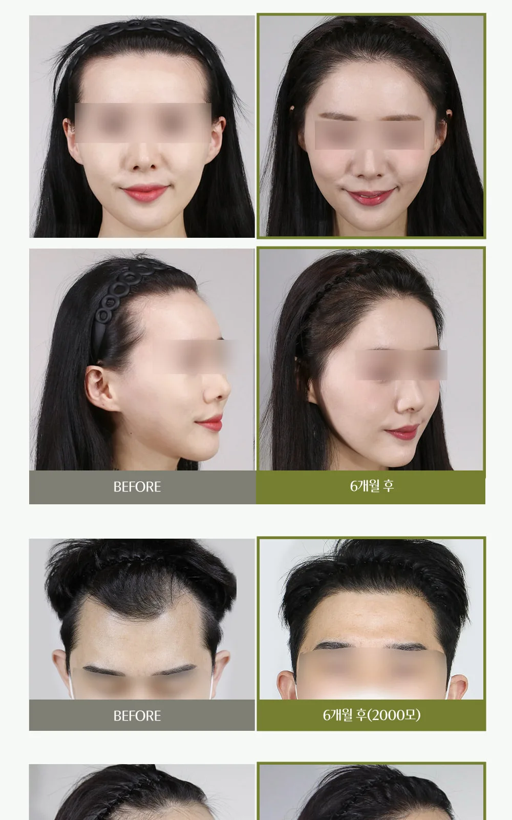 시술 상세 7