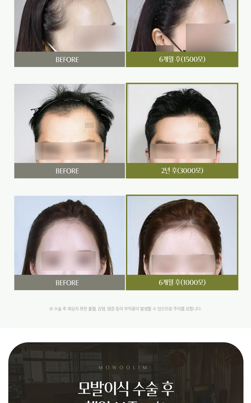 시술 상세 8
