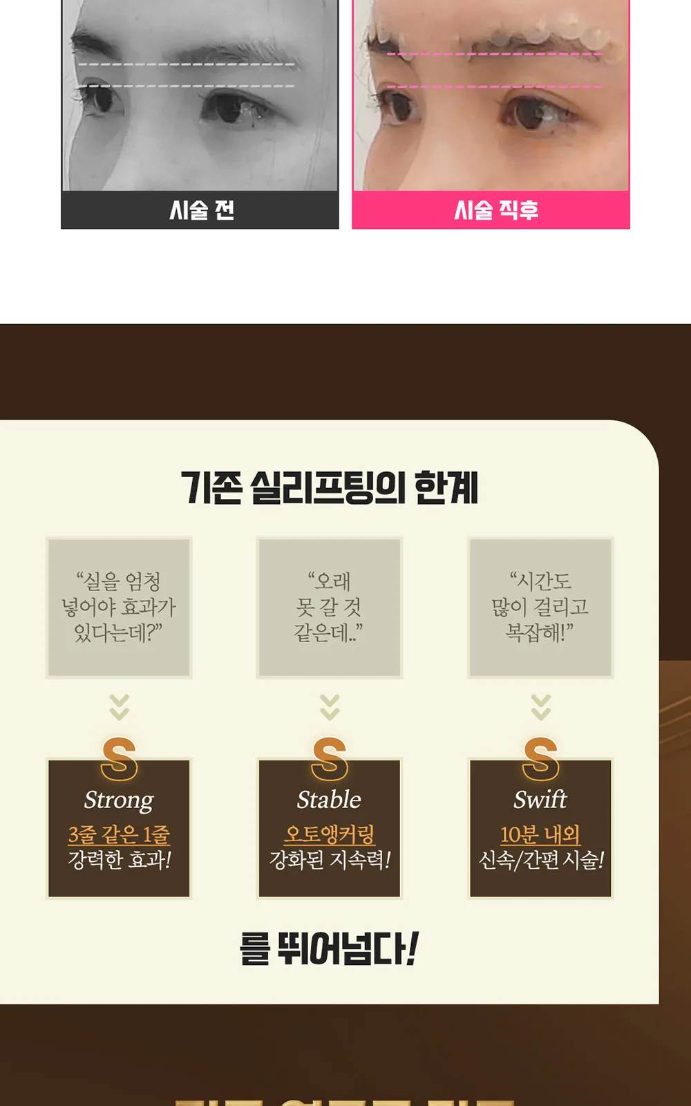 시술 상세 2