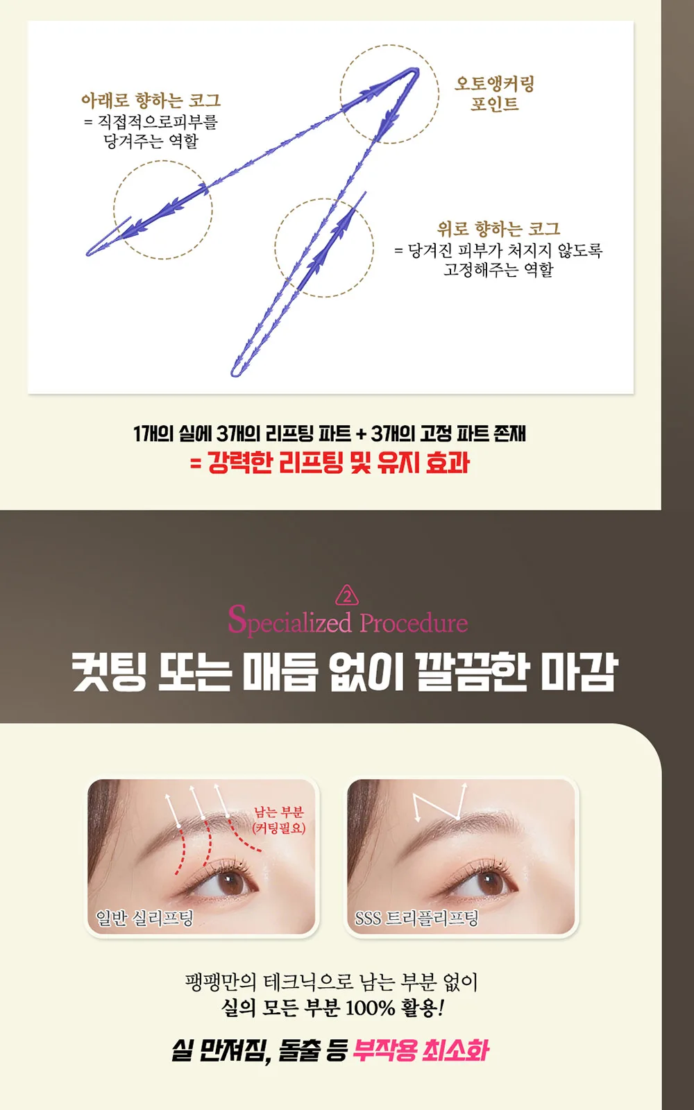 시술 상세 5
