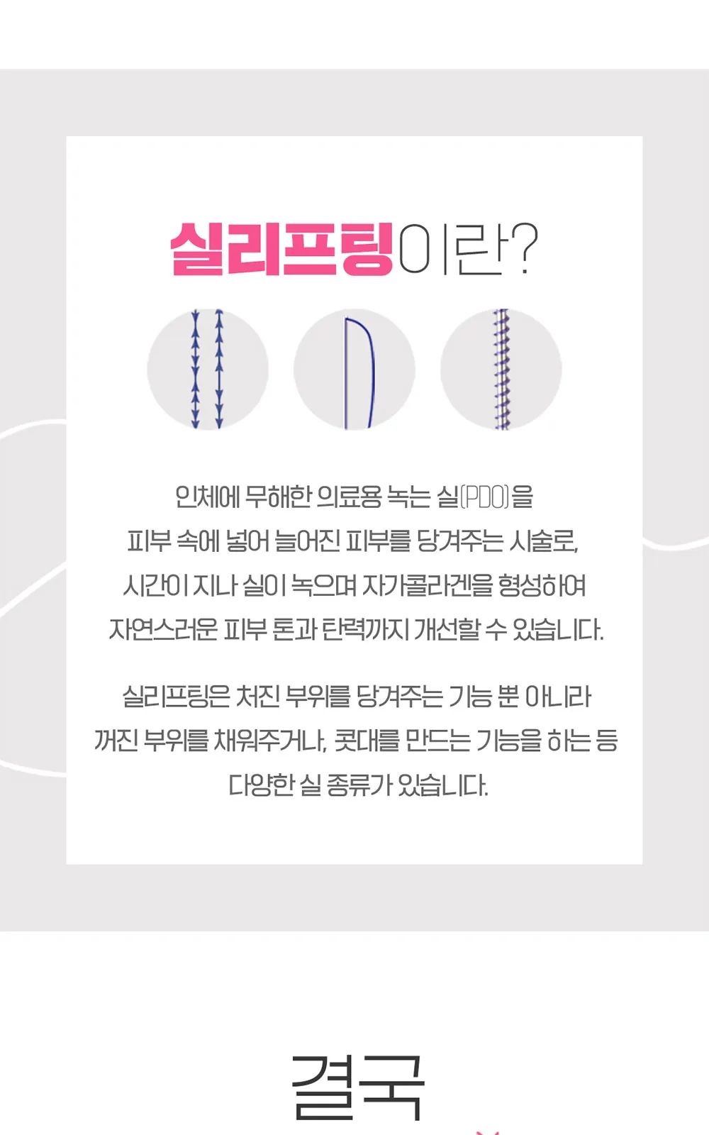 시술 상세 8