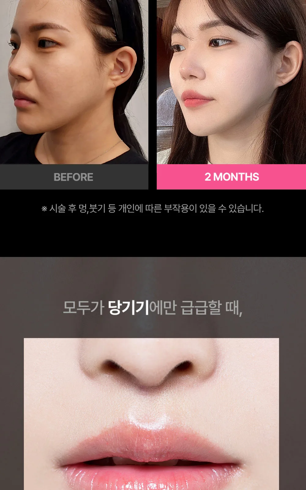 시술 상세 2