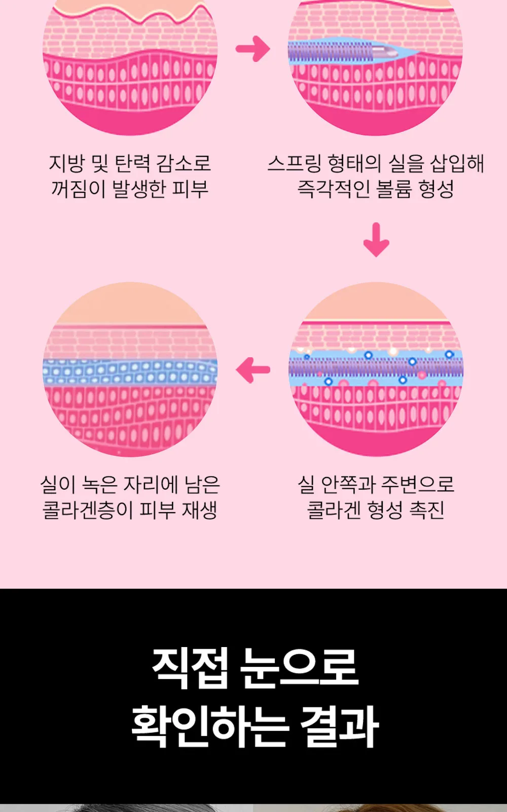 시술 상세 6