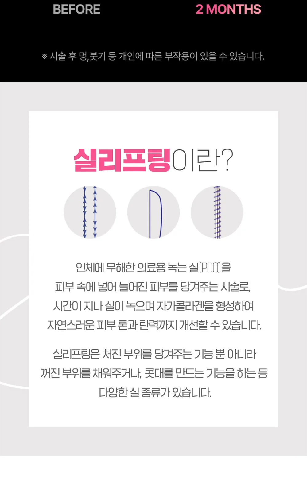 시술 상세 9