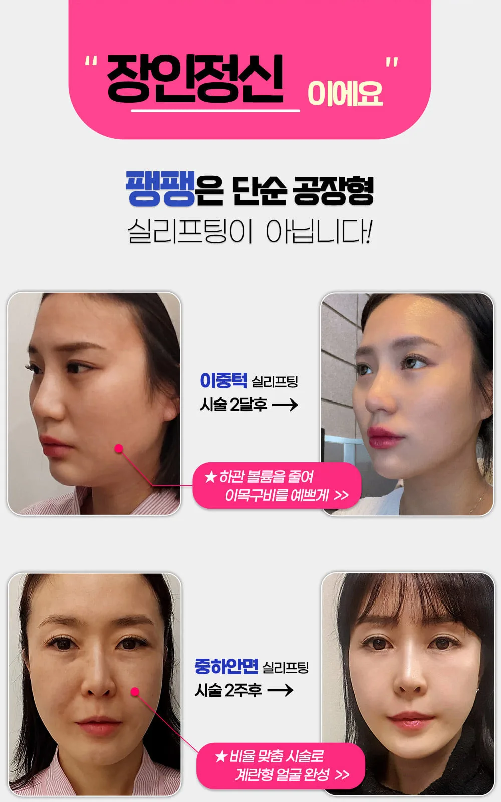 시술 상세 8