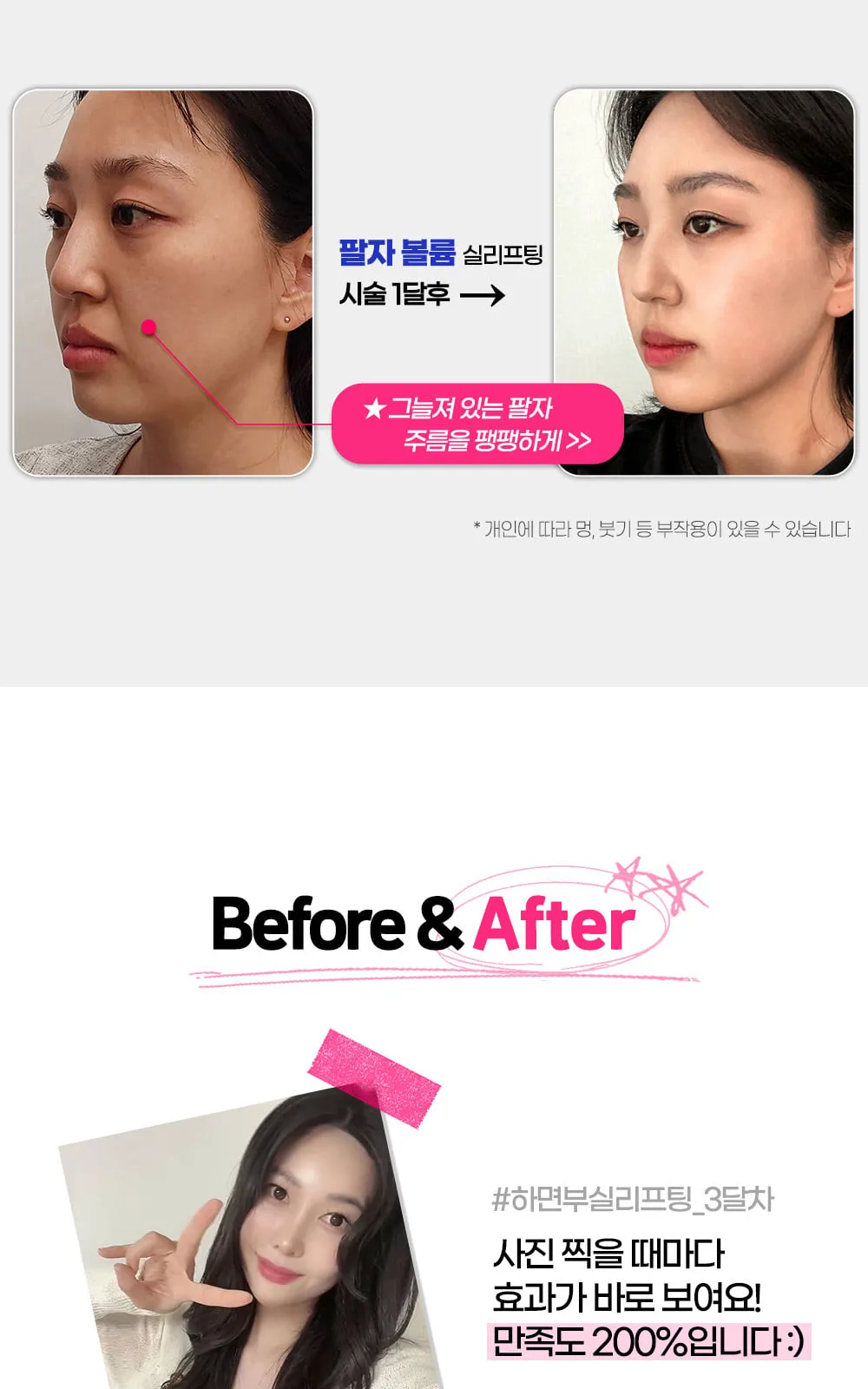 시술 상세 9