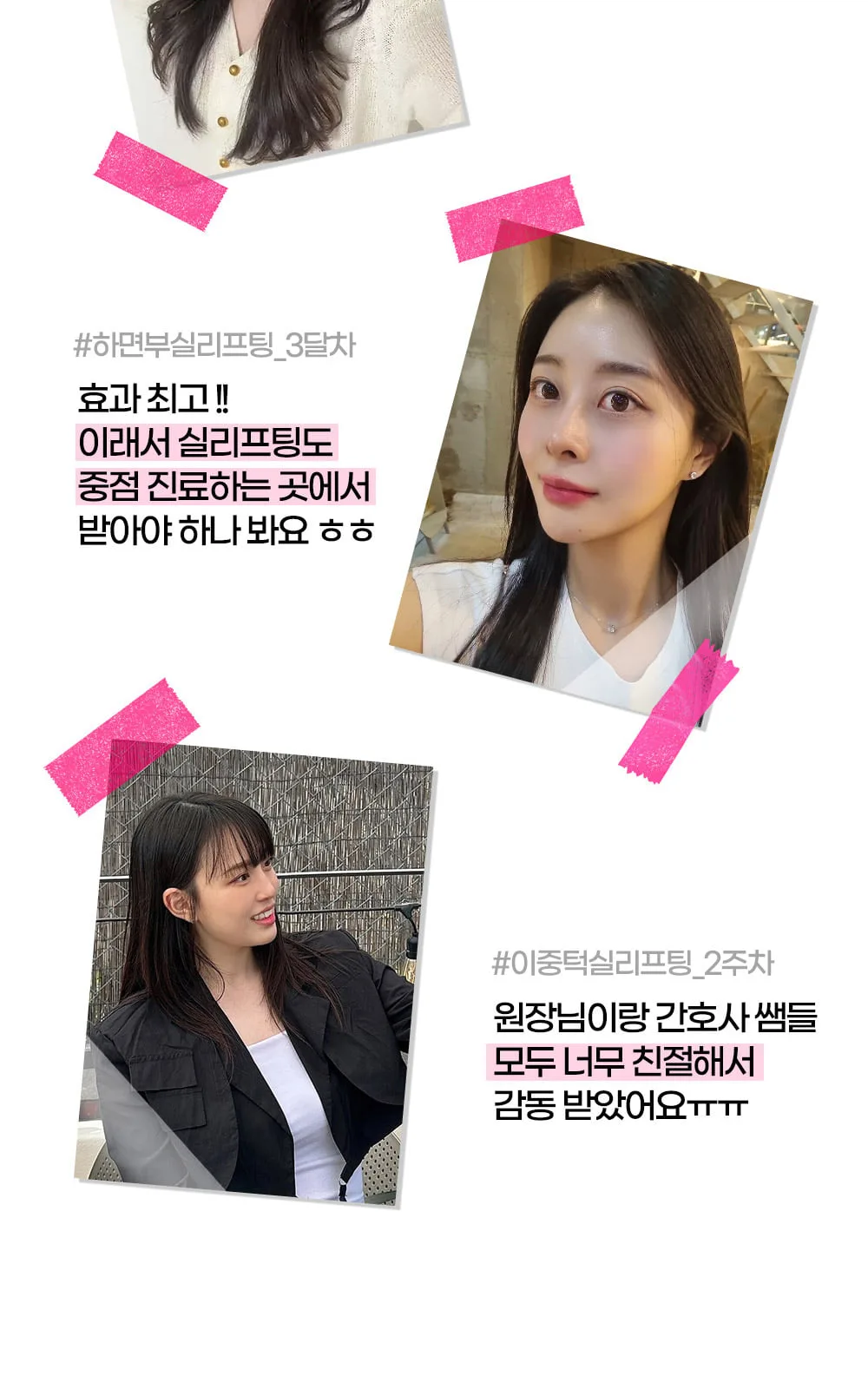 시술 상세 10