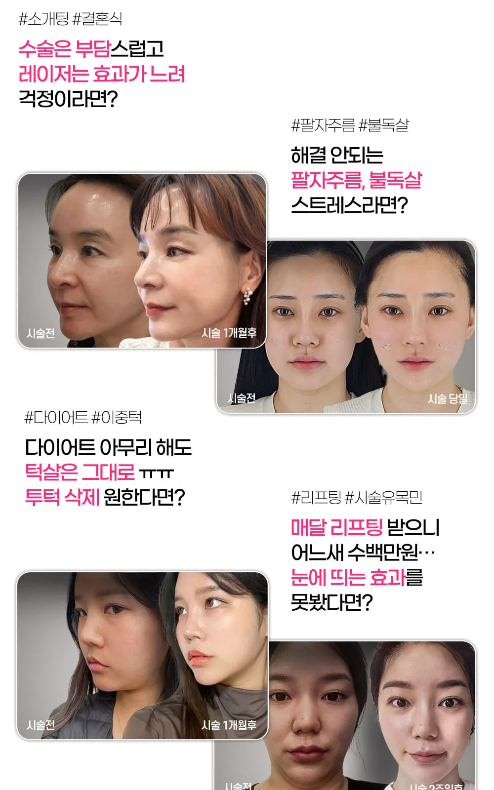 시술 상세 11