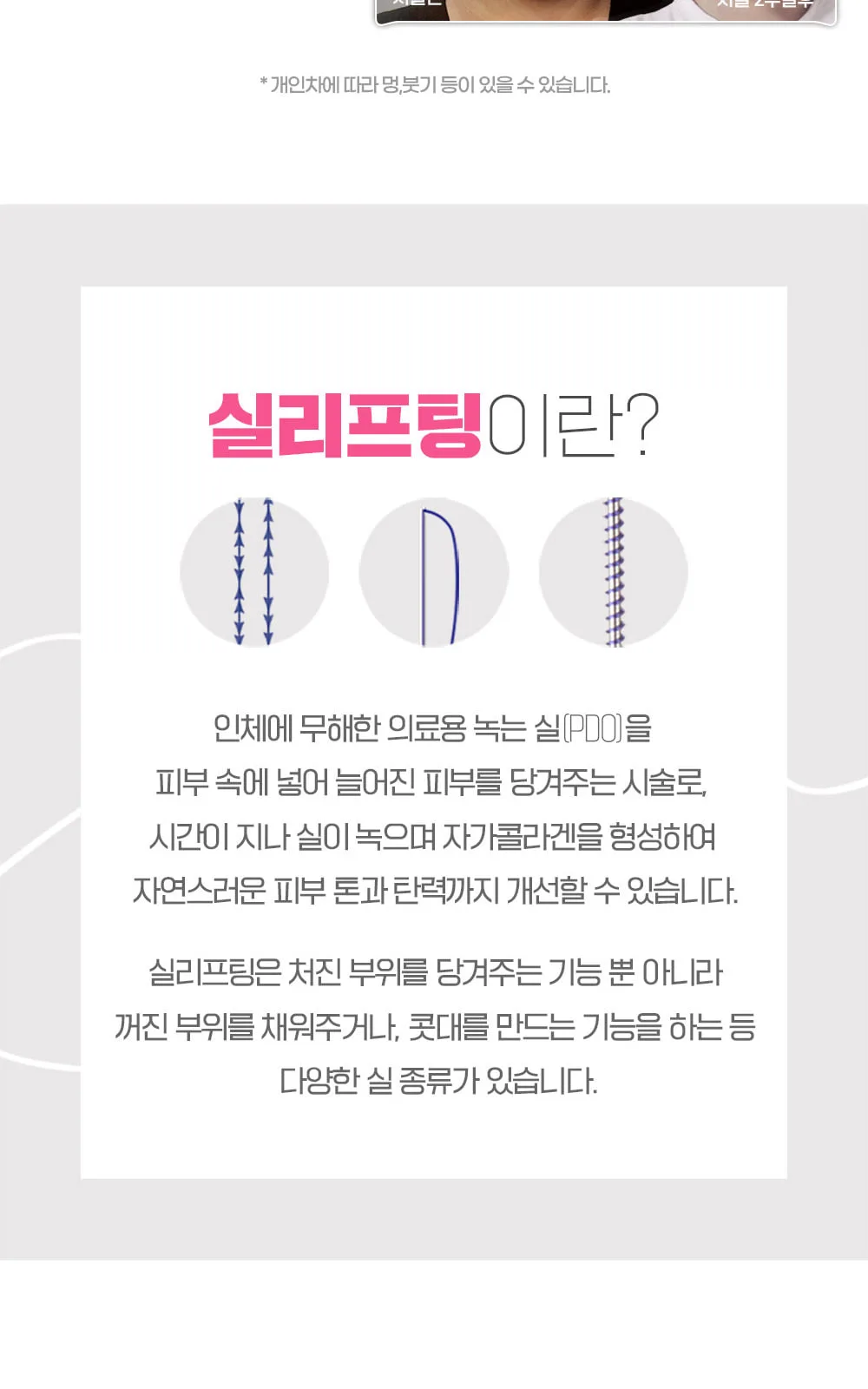 시술 상세 12