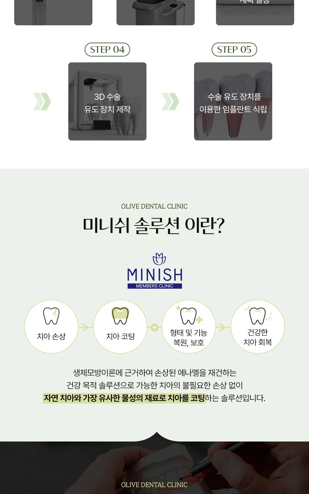 시술 상세 6