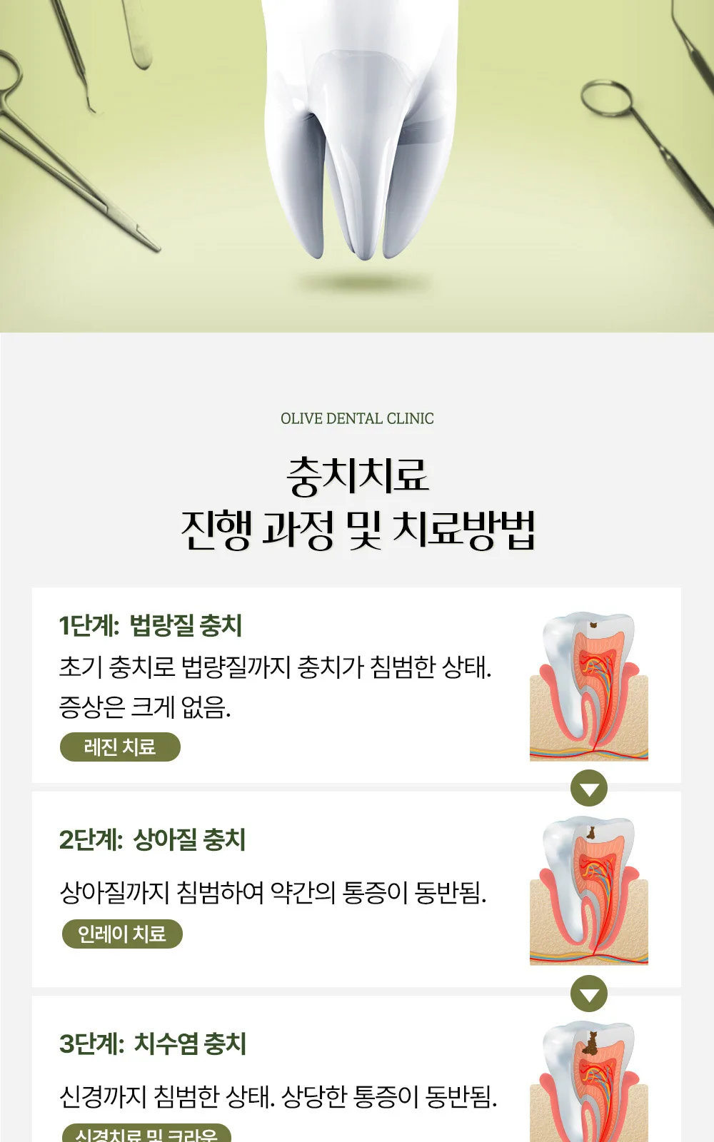 시술 상세 9