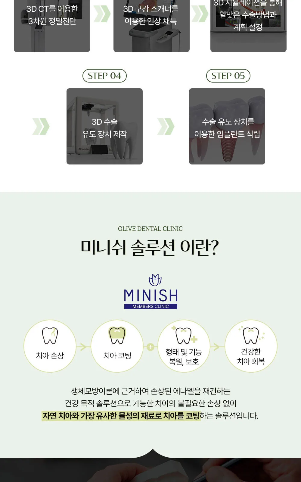 시술 상세 6
