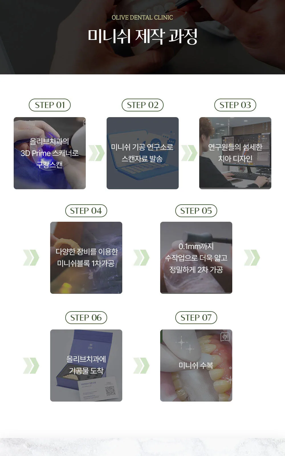 시술 상세 7