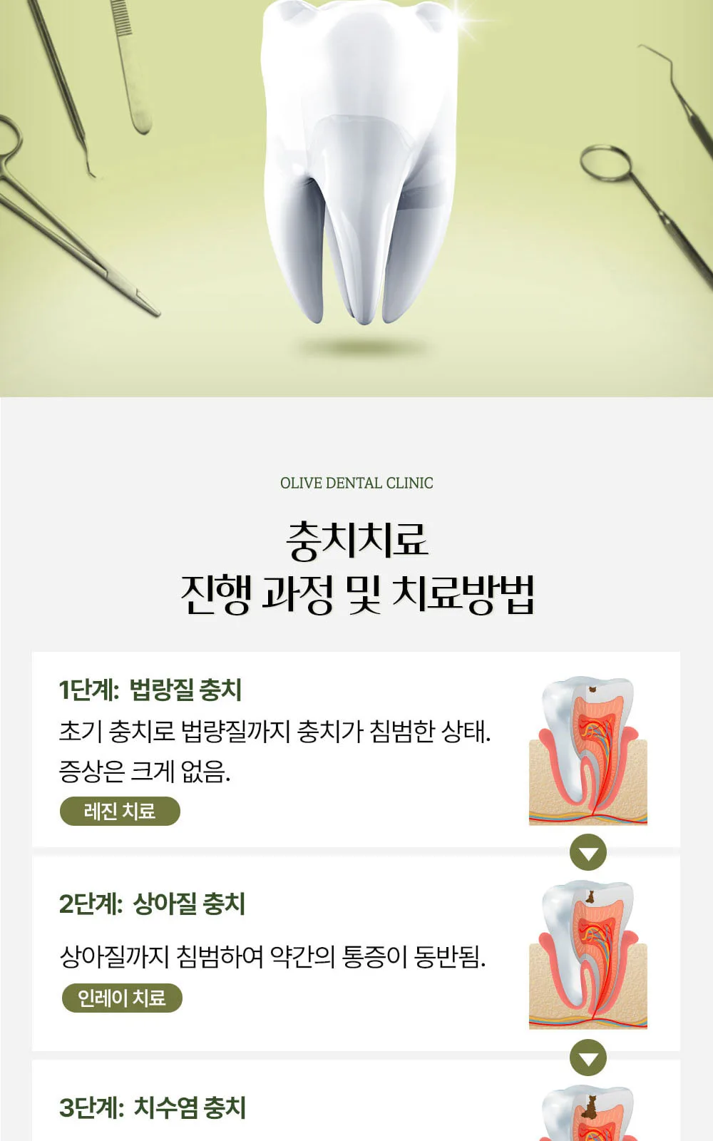 시술 상세 9