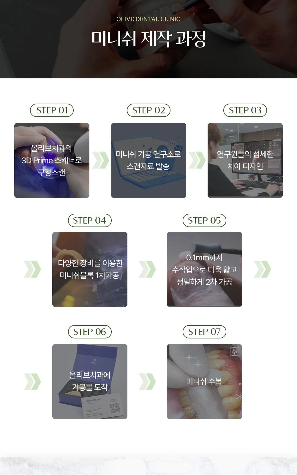 시술 상세 7