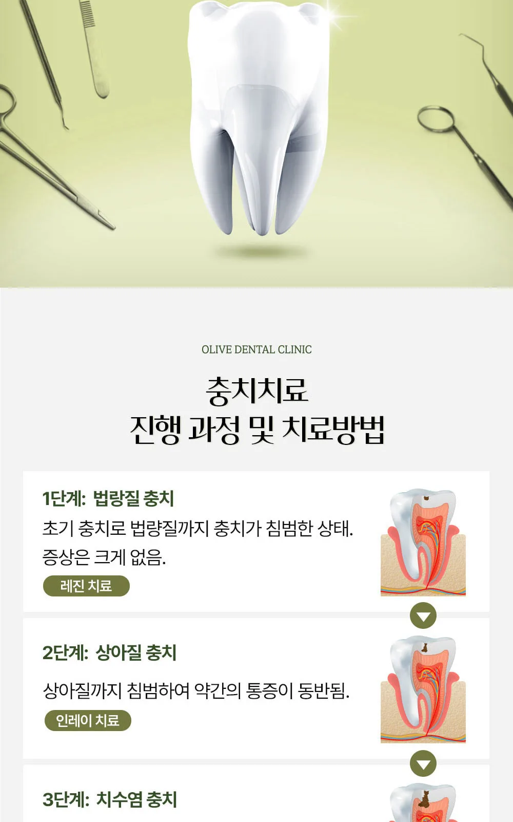 시술 상세 9