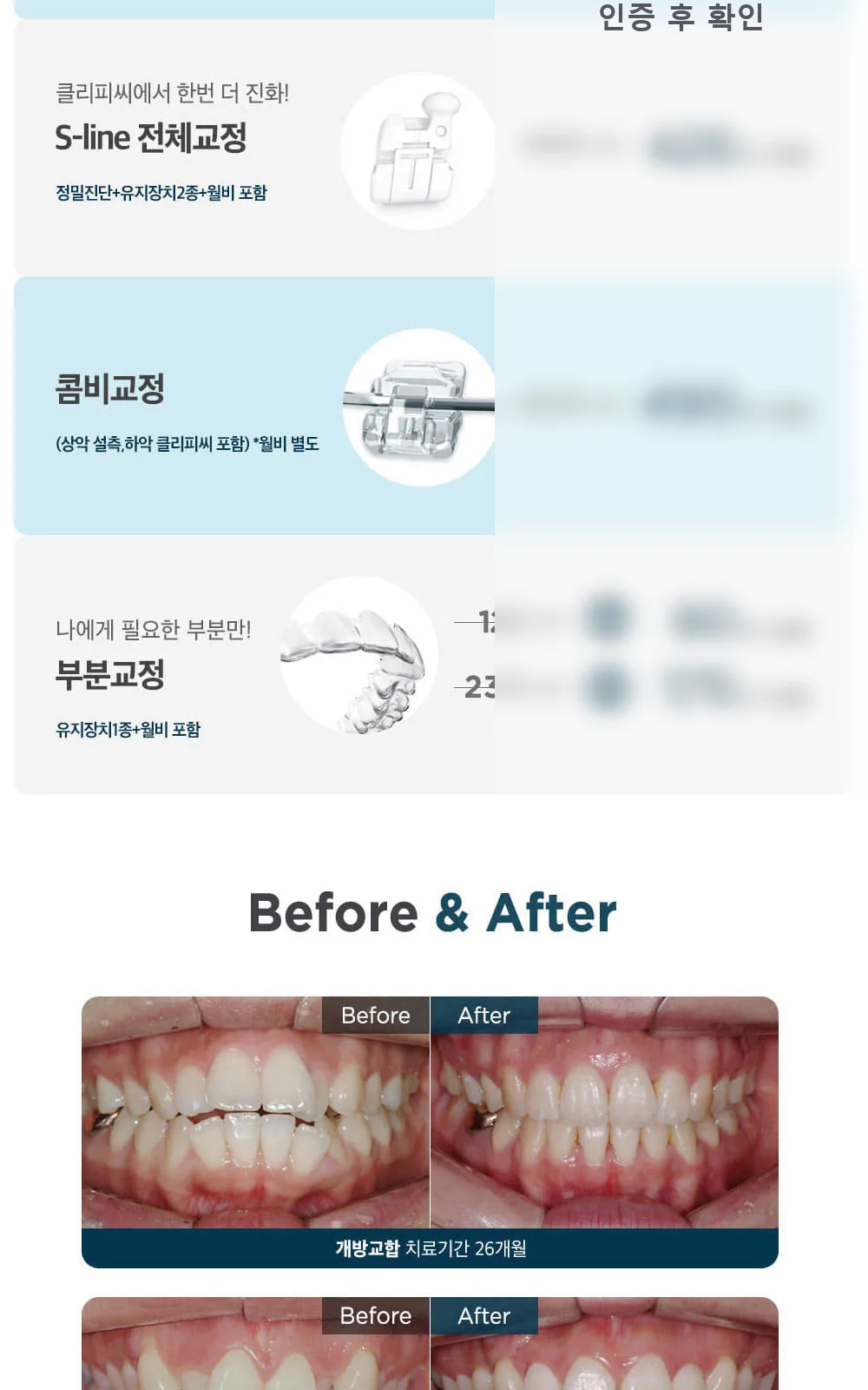 시술 상세 3