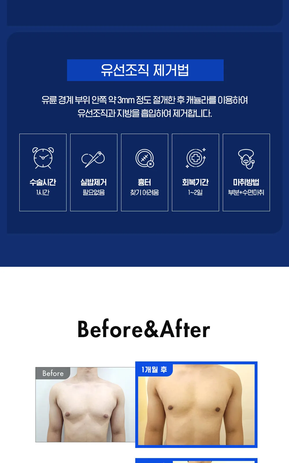 시술 상세 6