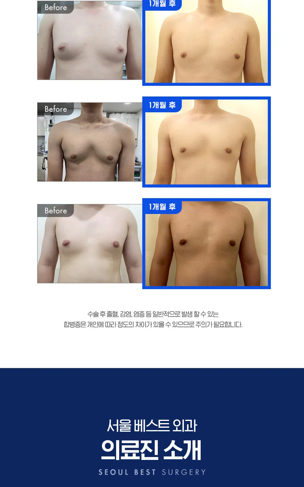 시술 상세 7