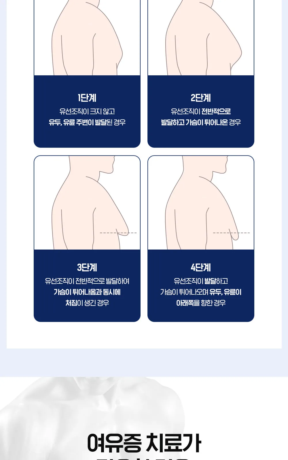 시술 상세 4