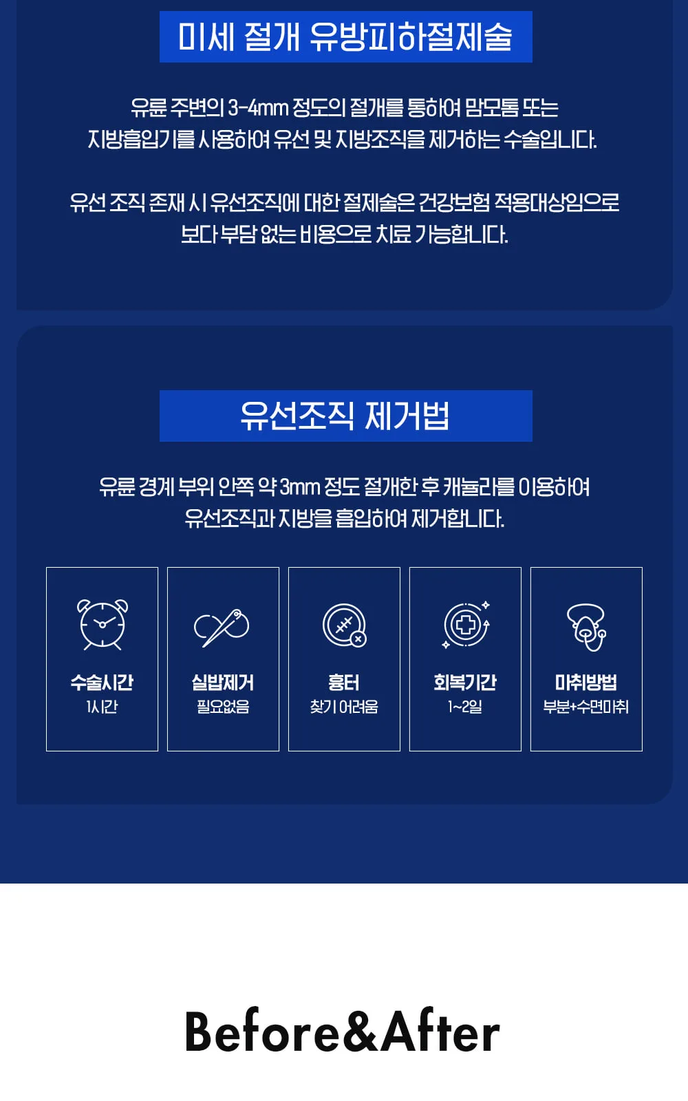 시술 상세 6