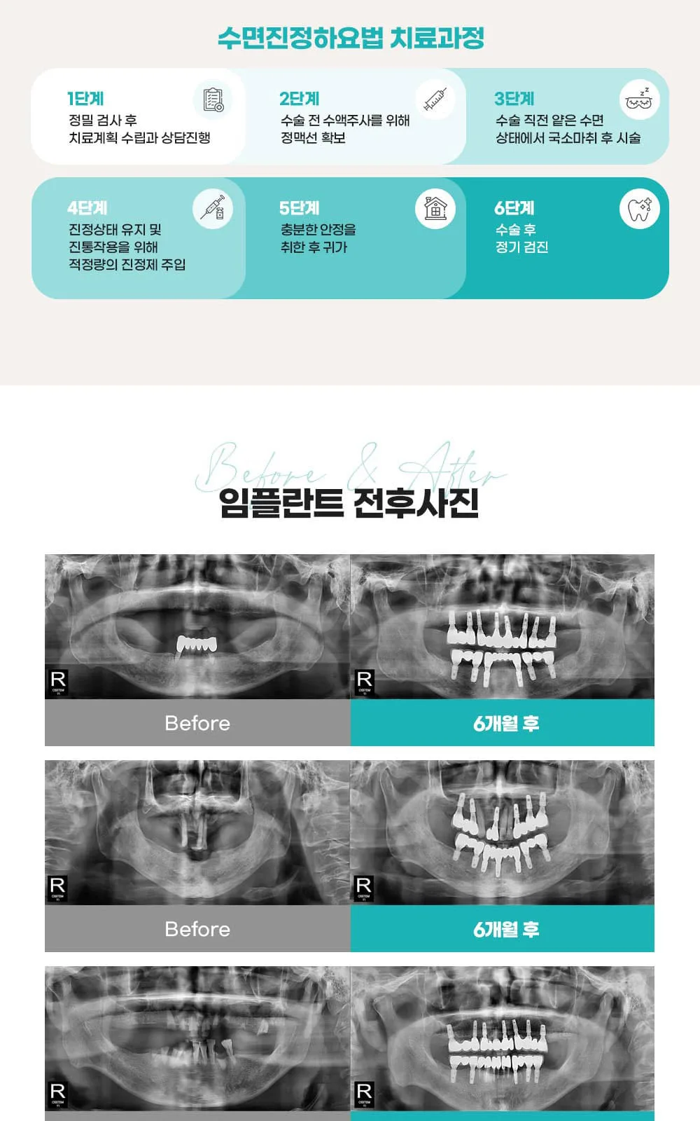 시술 상세 9