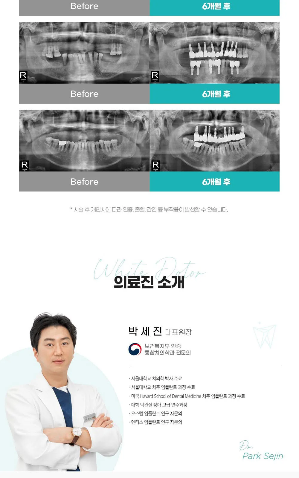시술 상세 10