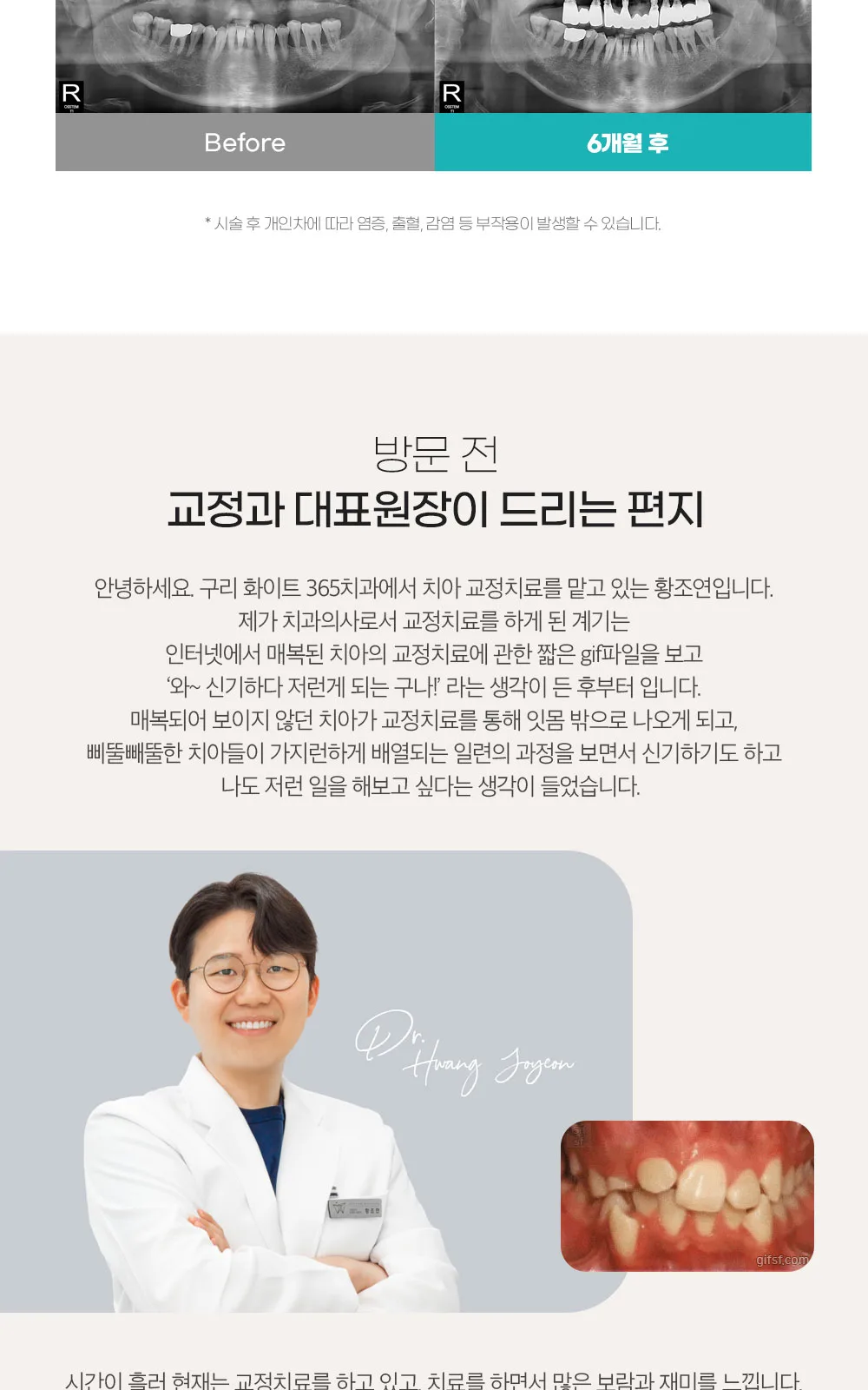 시술 상세 12