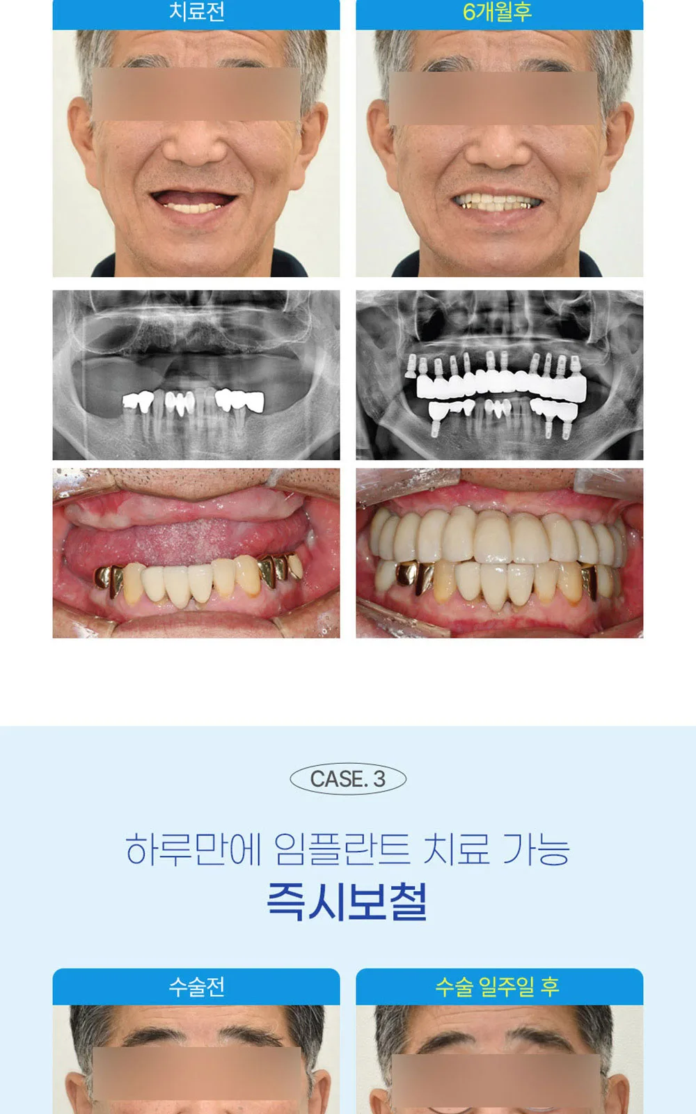 시술 상세 5