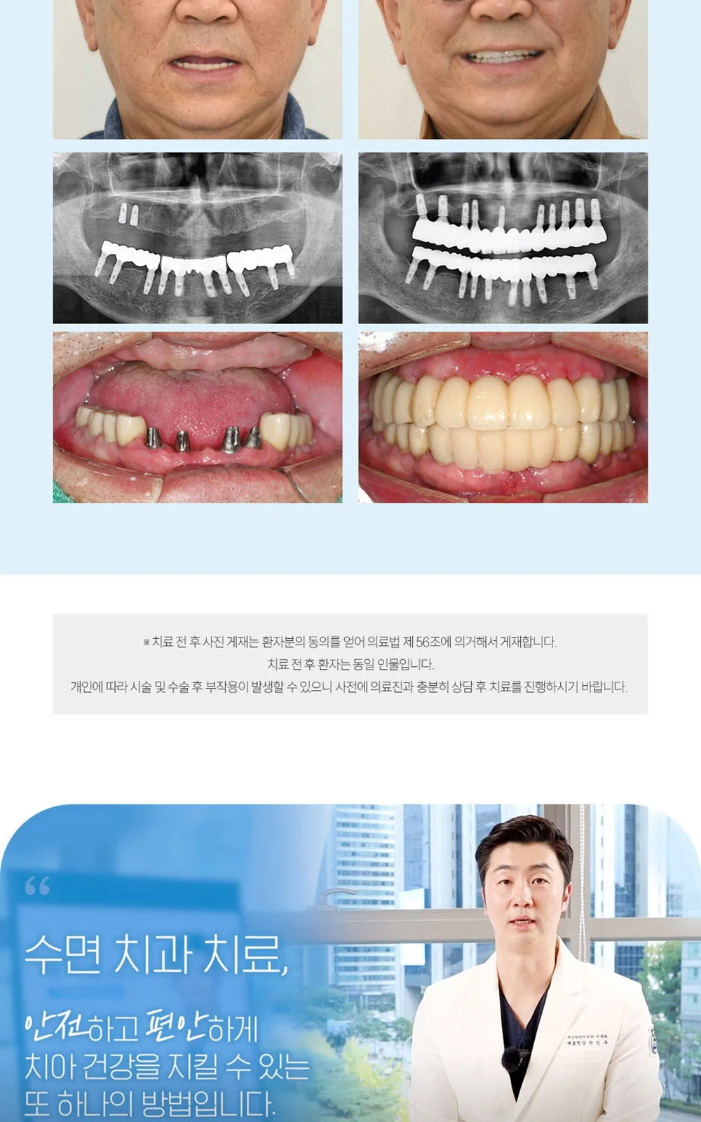 시술 상세 6