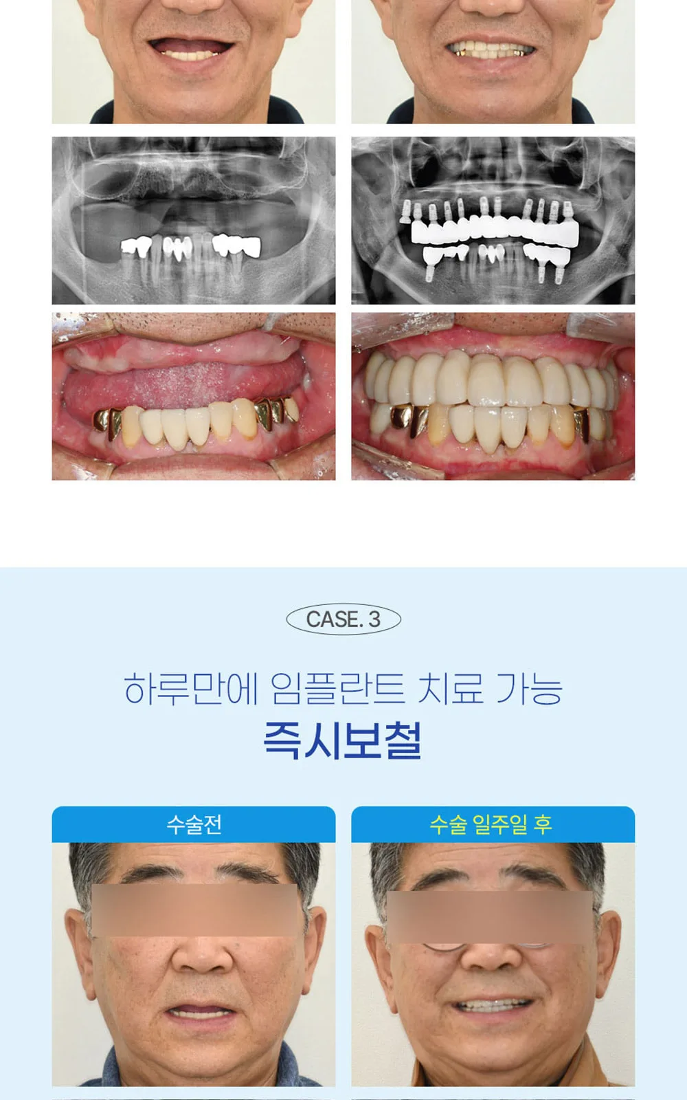 시술 상세 5