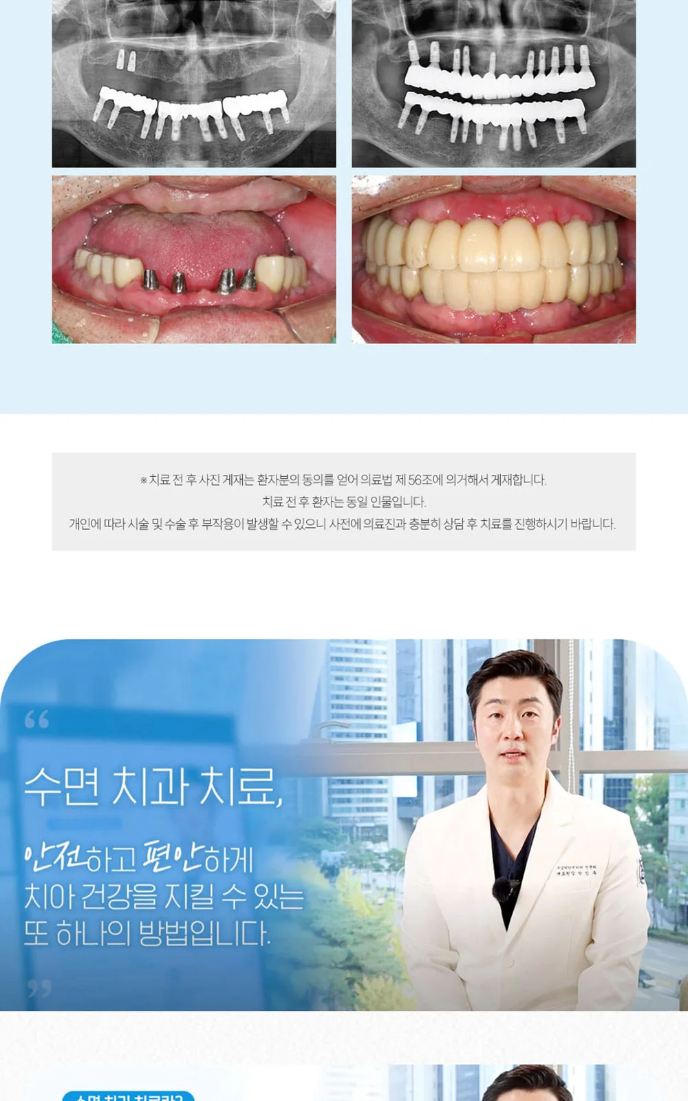 시술 상세 6