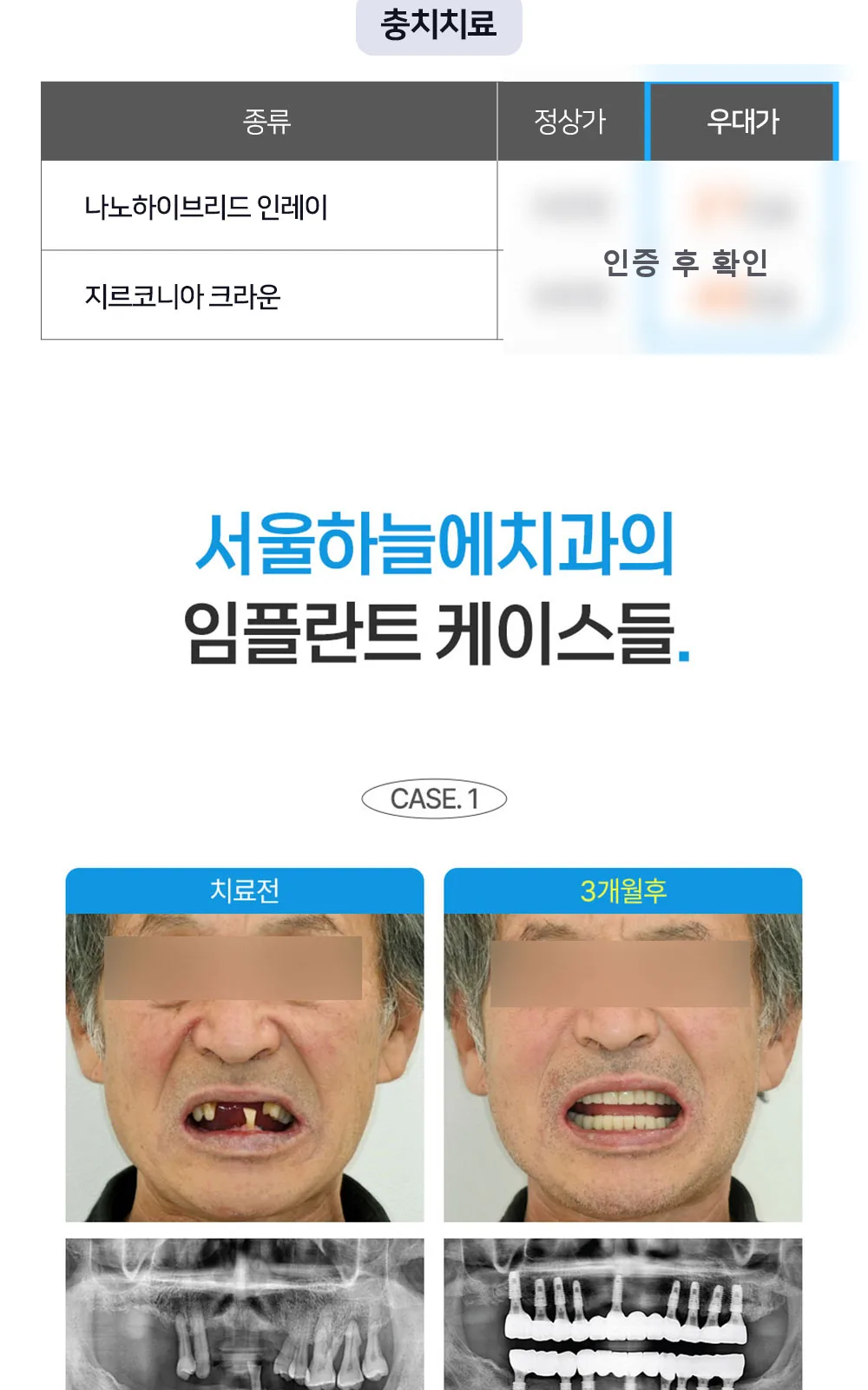 시술 상세 4