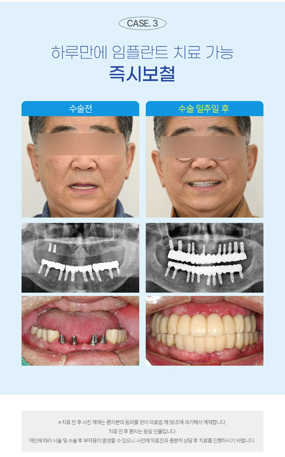 시술 상세 6