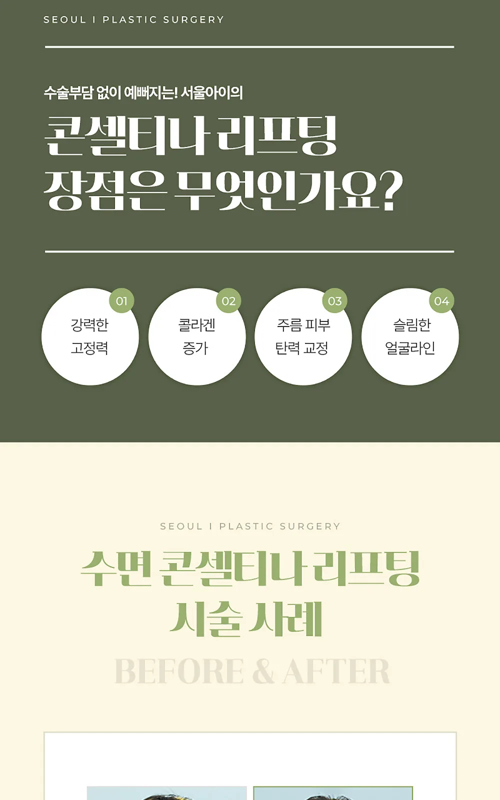 시술 상세 8