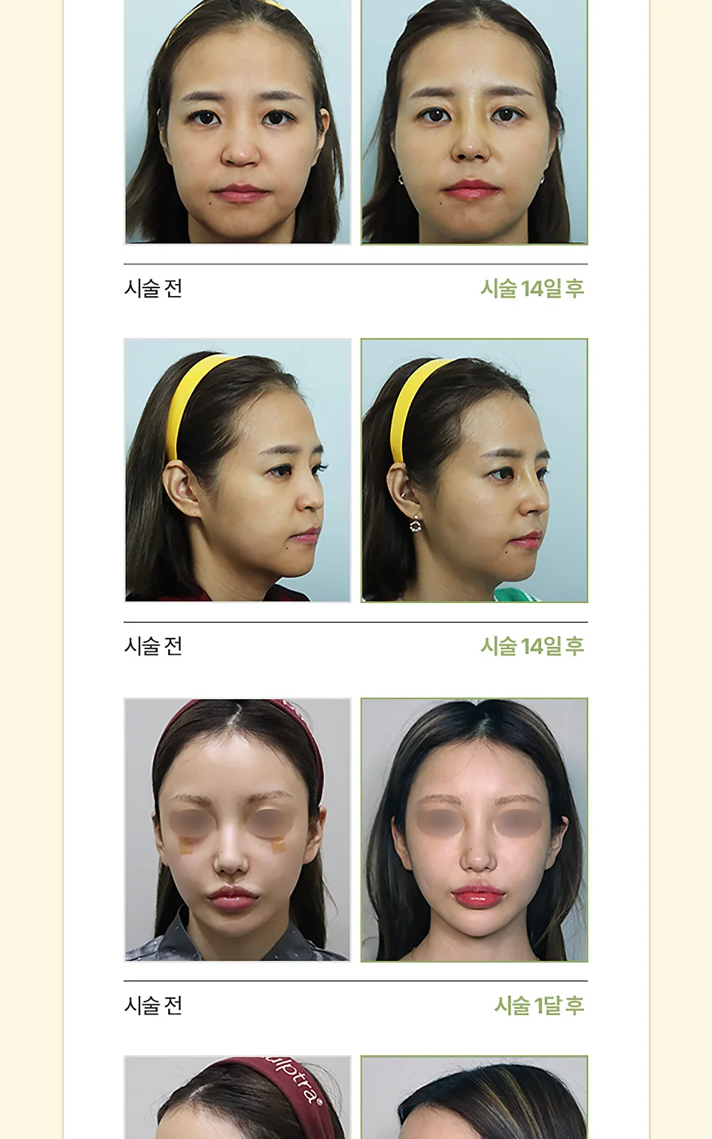 시술 상세 9